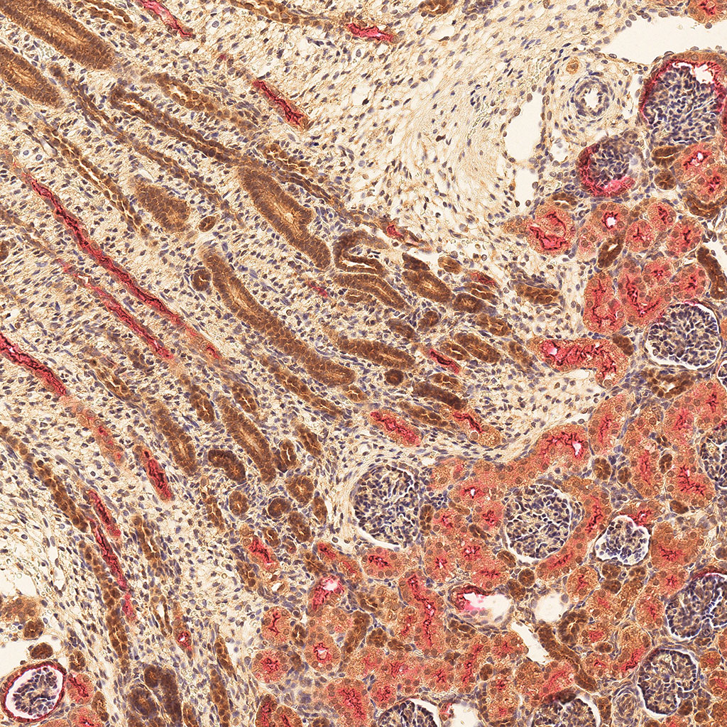 sars-cov-2 gene expression in a human fetus